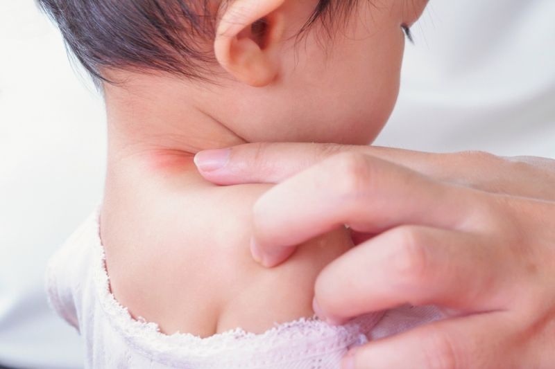 Обривите при децата: Кога е алергия?
