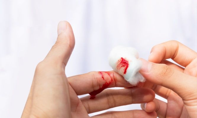7 ефективни начина за спиране на кървене в домашни условия